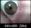 coeur-a-2-yeux-de-differentes-couleurs-photo036.jpg