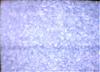 neige-tv-noire-blanche-lantenne.jpg