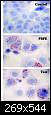 Cancer du sein : nouveaux m�canismes identifi�s pour le tamoxif�ne.-f1.large.jpg