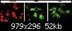 Cancer du sein : nouveaux m�canismes identifi�s pour le tamoxif�ne.-f3.large.jpg