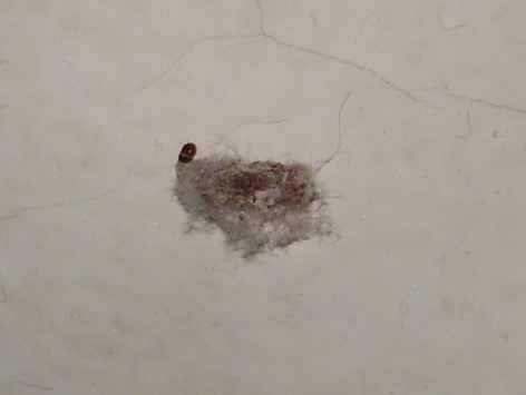 Ver, larve étrange sur les murs de ma maison